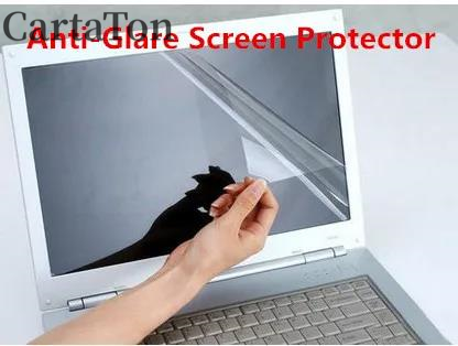 2 STUKS Anti-Glare reflectie M - Matte Anti Glare Screen recensie en prijs